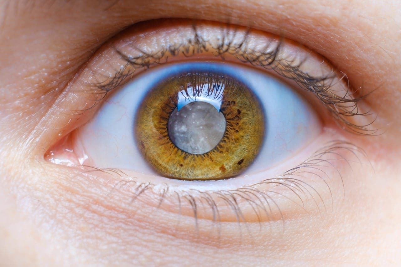 Close-up of a human eye with brown and green hues in the iris and a visible reflection.